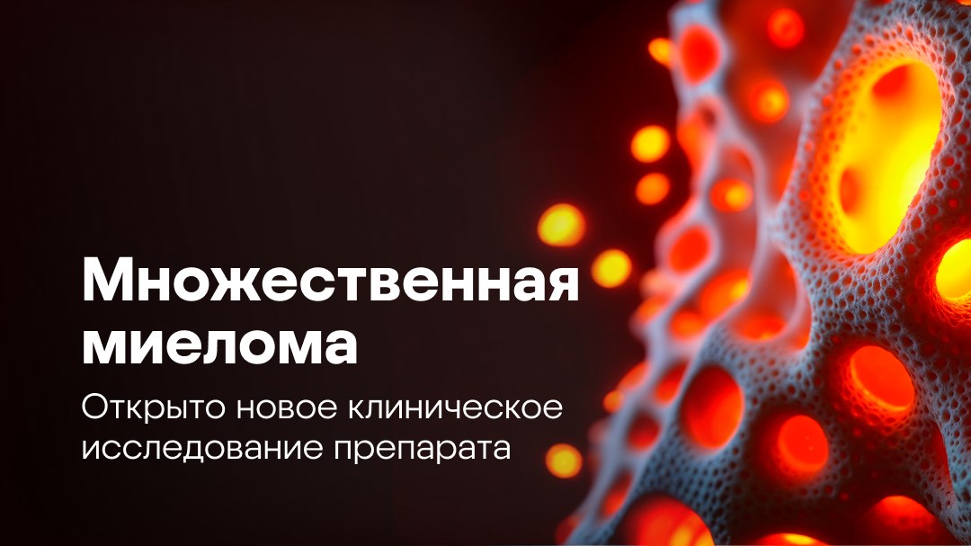 Множественная миелома: исследования